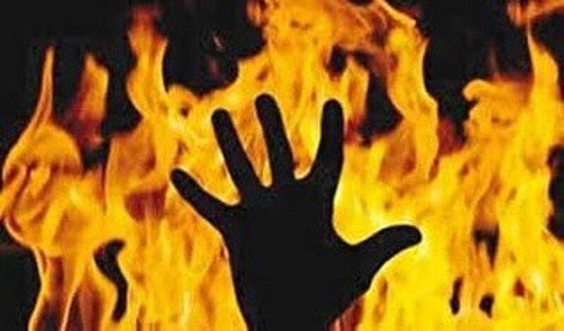 نمایشگاه عکس و قصه‌ رهیدگان سوختگی برگزار می‌شود